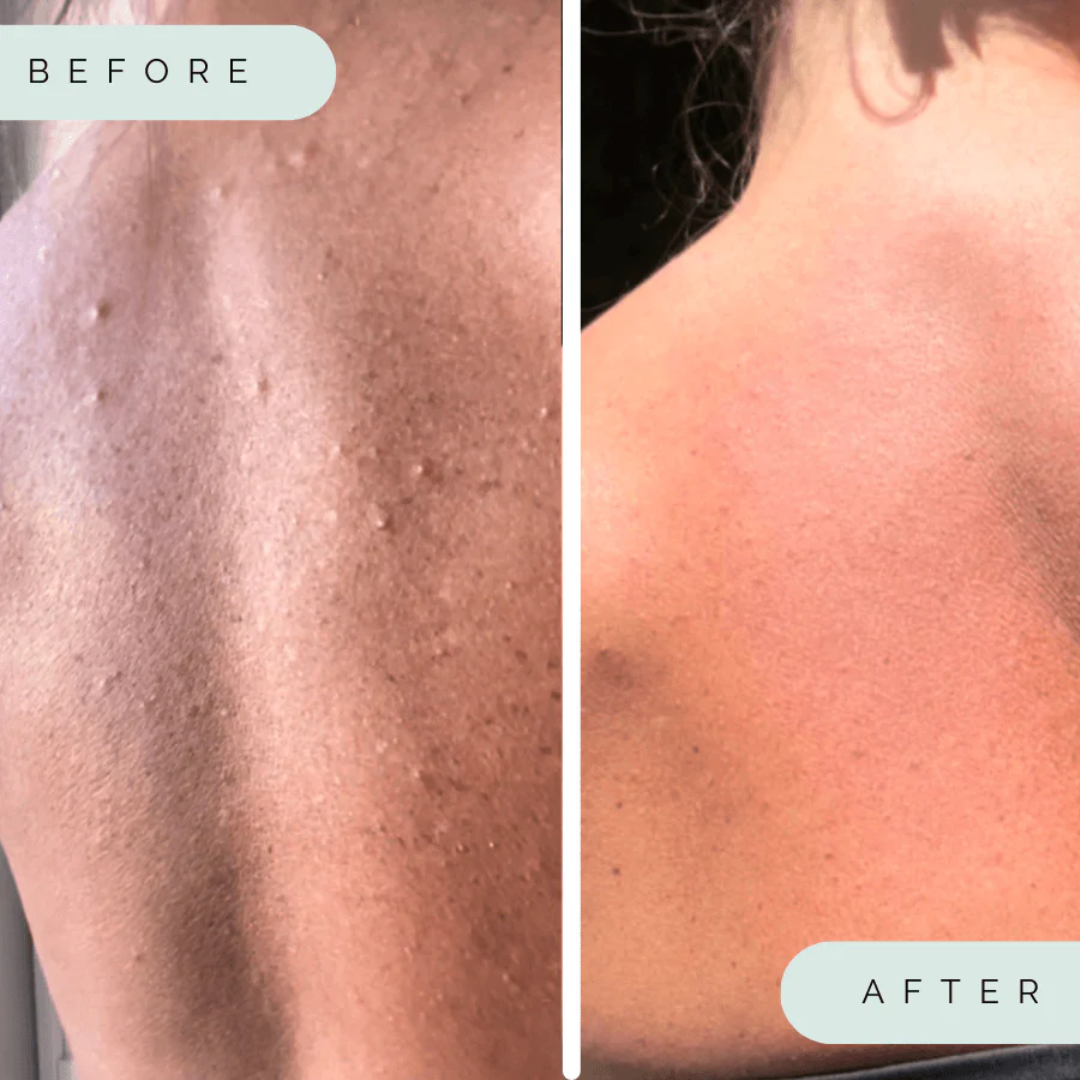 A white, textured exfoliating washcloth with three black stripes along the top edge. Before and after photo.